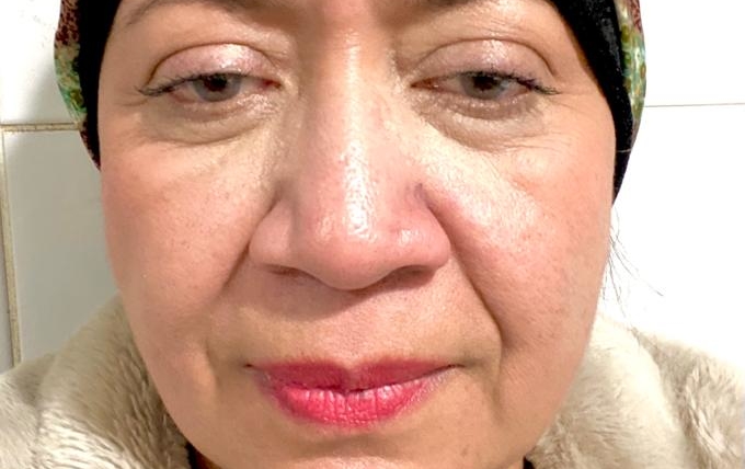 Dr. Amal El-Gohary-Ahmed